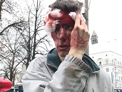 Милицейская машина сбила человека