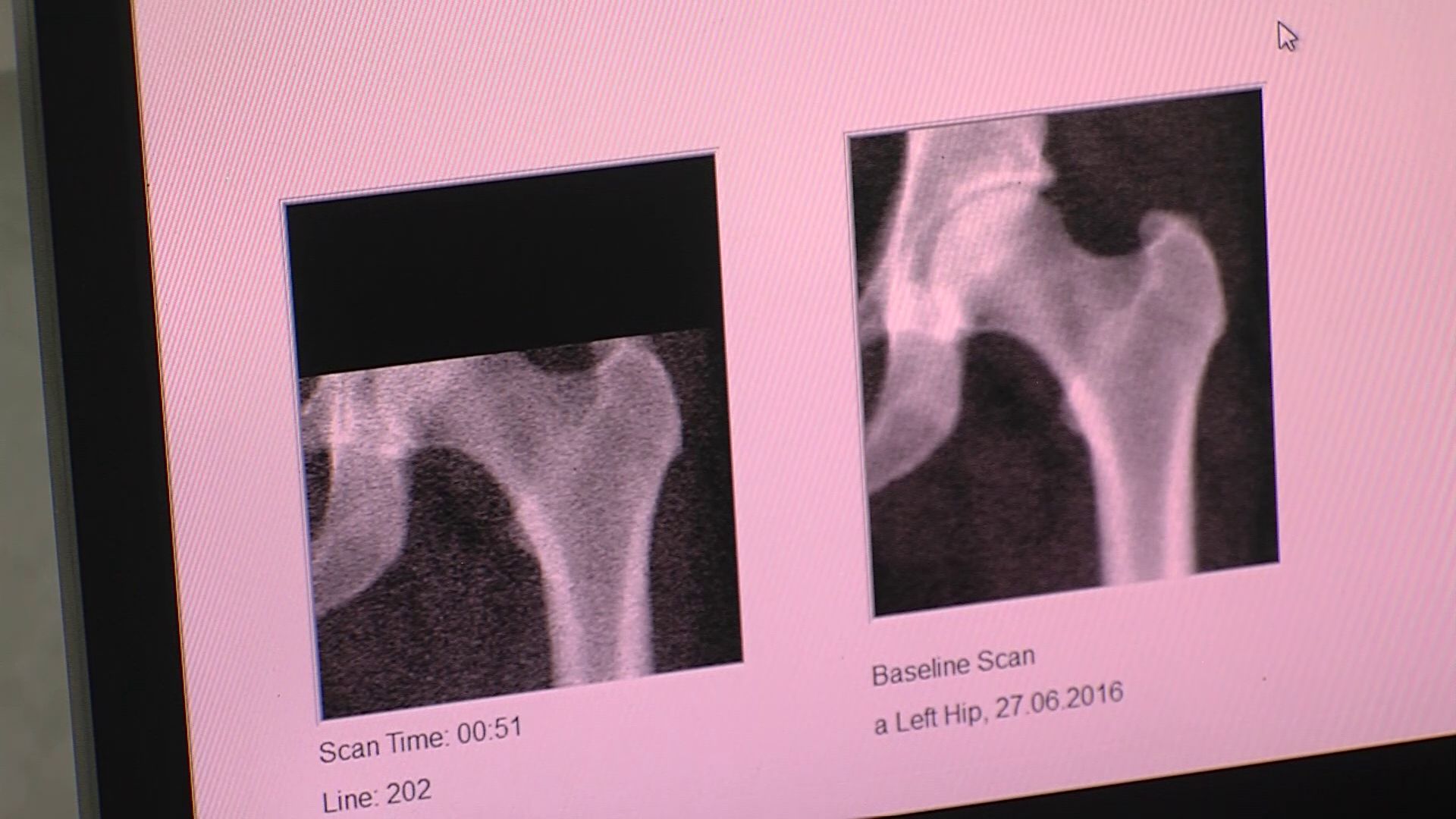 В областном центре по лечению остеопороза провели день открытых дверей