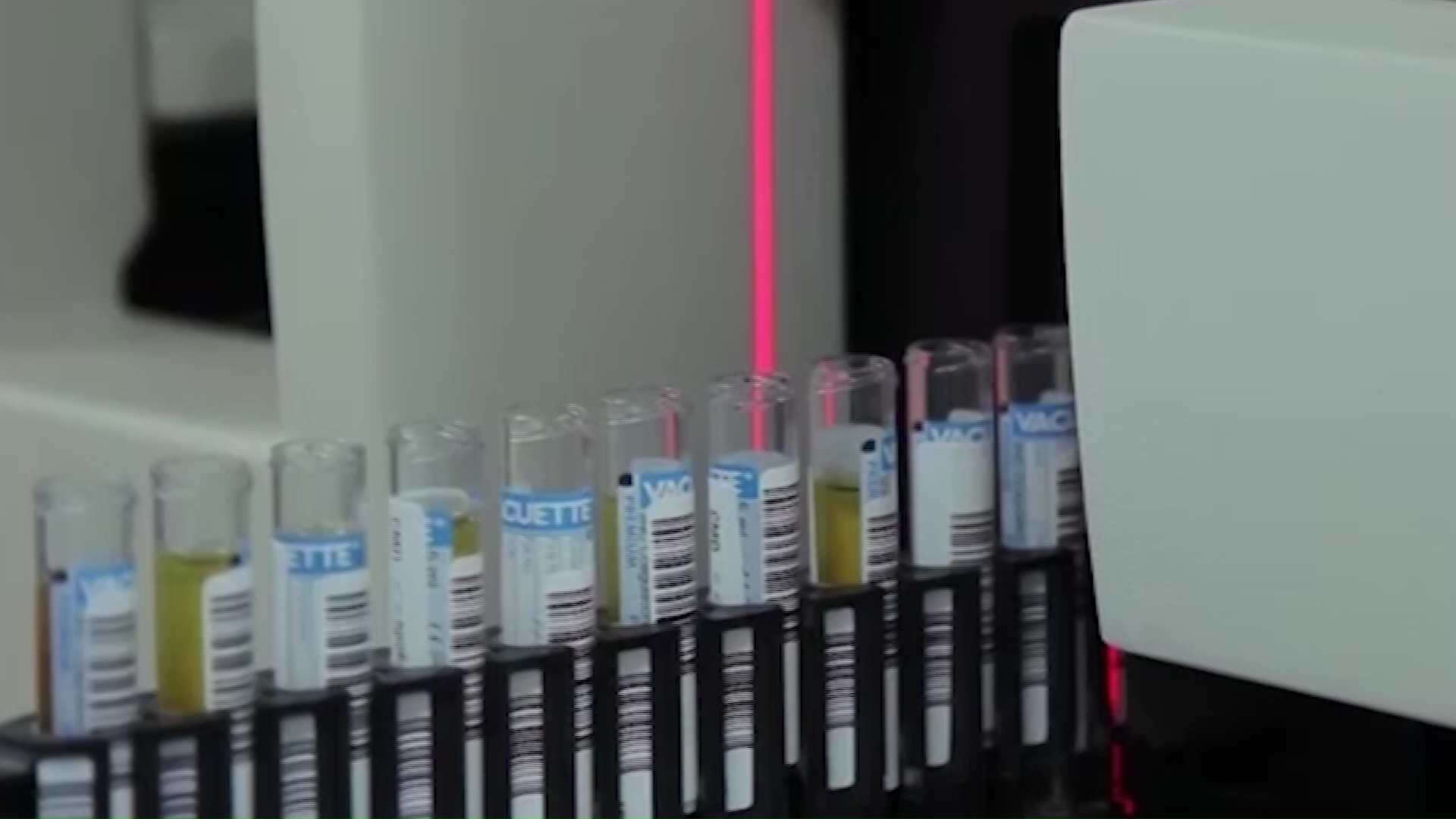 Результат почти мгновенный: на покупку новых тестов на коронавирус выделено 15 миллионов рублей