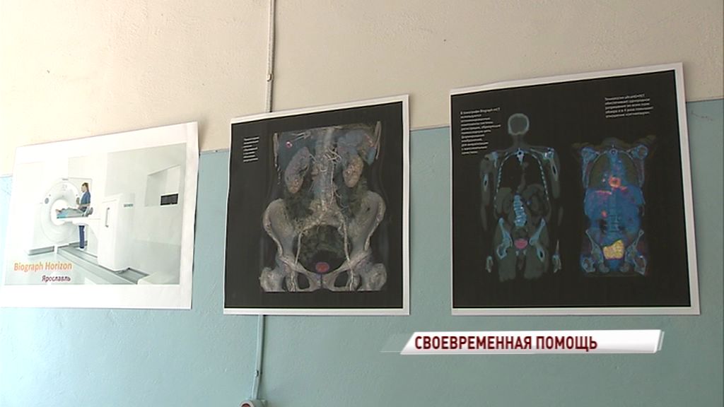 У ярославских пациентов смогут выявлять рак на ранней стадии с помощью ПЭ-томографа