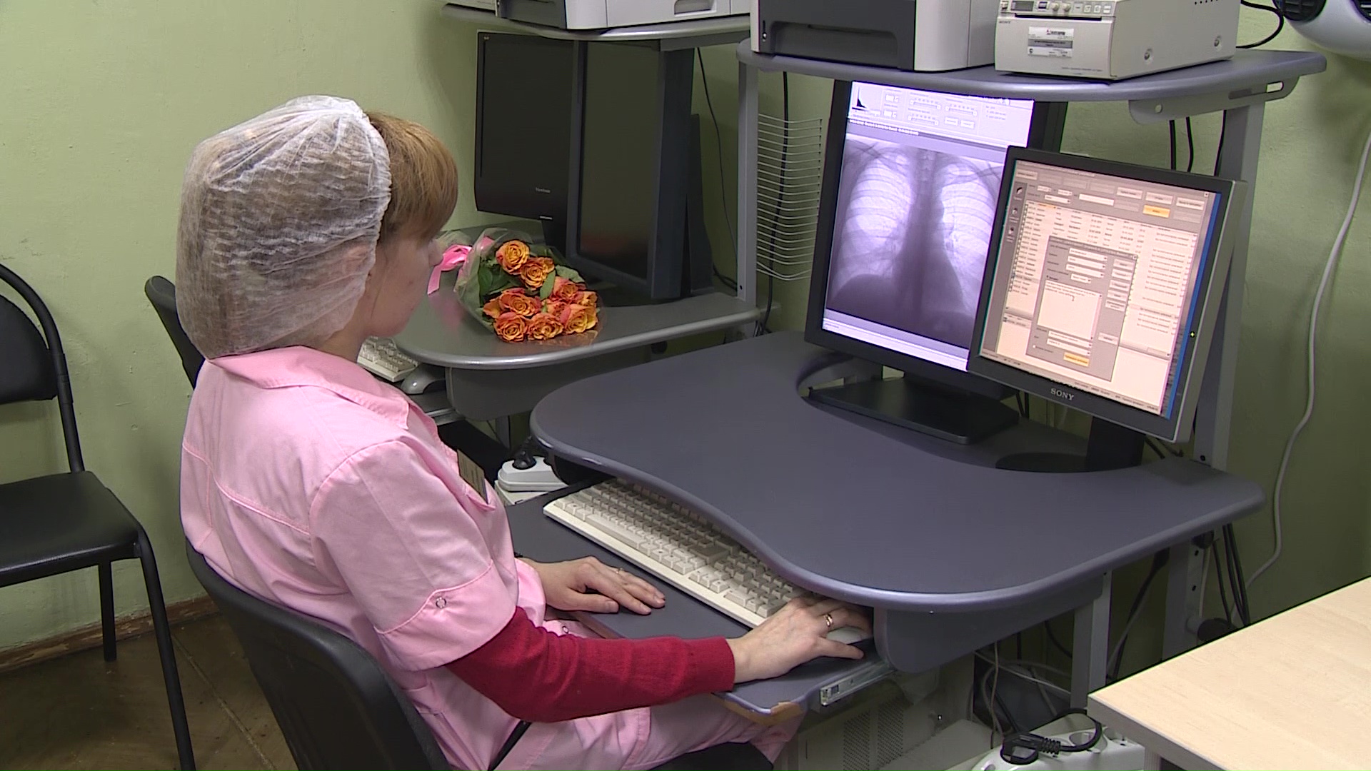 За год в Ярославской области выявили 300 случаев туберкулеза благодаря своевременным осмотрам